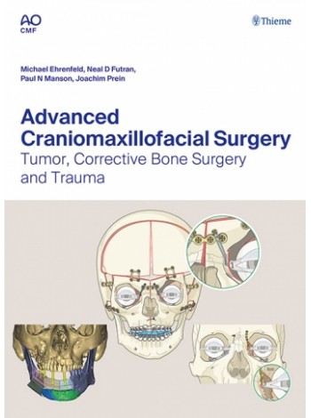 Advanced Craniomaxillofacial Surgery